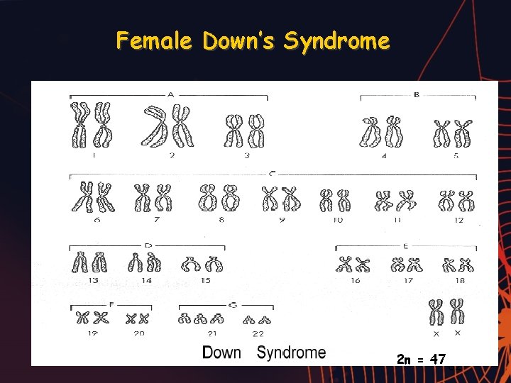 Female Down’s Syndrome 2 n = 47 32 