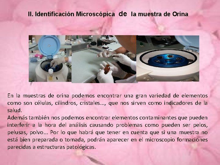II. Identificación Microscópica de la muestra de Orina En la muestras de orina podemos