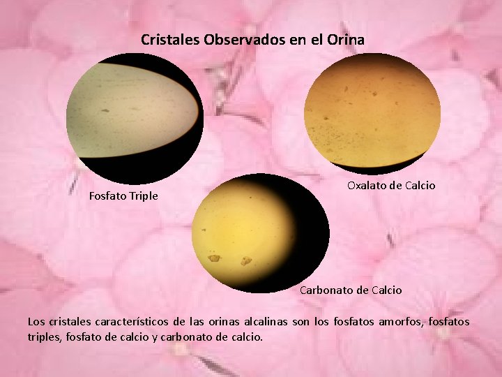 Cristales Observados en el Orina Fosfato Triple Oxalato de Calcio Carbonato de Calcio Los