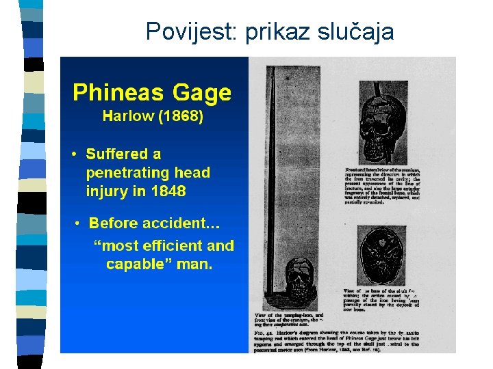 Povijest: prikaz slučaja 