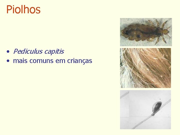 Piolhos • Pediculus capitis • mais comuns em crianças 