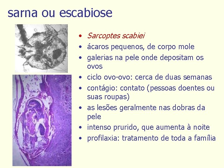 sarna ou escabiose • Sarcoptes scabiei • ácaros pequenos, de corpo mole • galerias