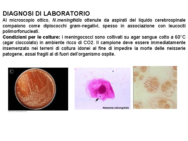 DIAGNOSI DI LABORATORIO Al microscopio ottico, N. meningitidis ottenute da aspirati del liquido cerebrospinale