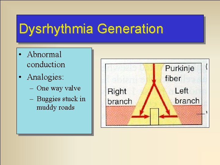 Dysrhythmia Generation • Abnormal conduction • Analogies: – One way valve – Buggies stuck