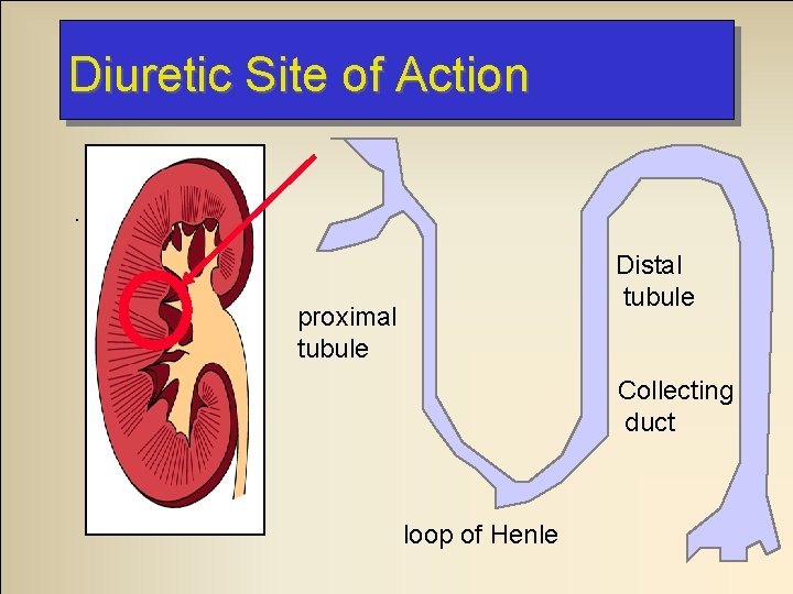 Diuretic Site of Action. Distal tubule proximal tubule Collecting duct loop of Henle 