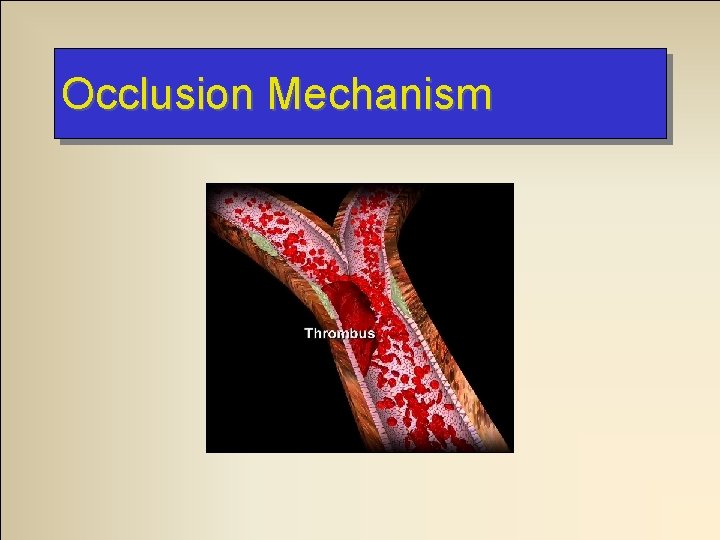 Occlusion Mechanism 