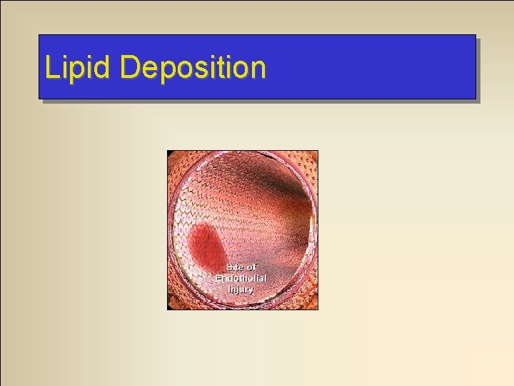 Lipid Deposition 