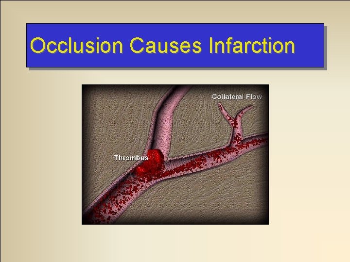Occlusion Causes Infarction 