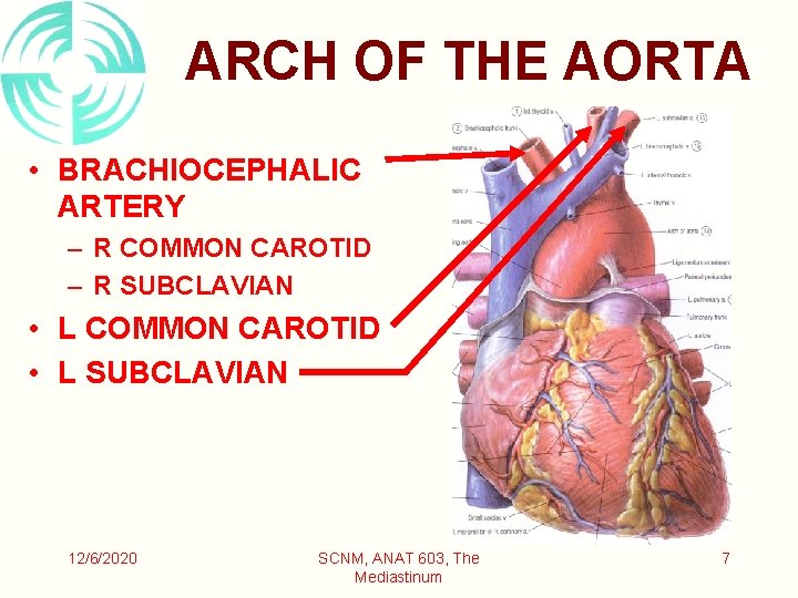 ARCH OF THE AORTA • BRACHIOCEPHALIC ARTERY – R COMMON CAROTID – R SUBCLAVIAN