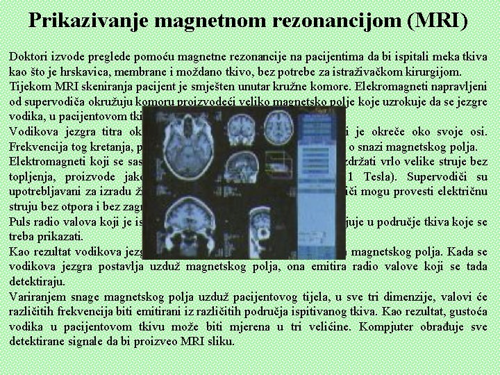 Prikazivanje magnetnom rezonancijom (MRI) Doktori izvode preglede pomoću magnetne rezonancije na pacijentima da bi