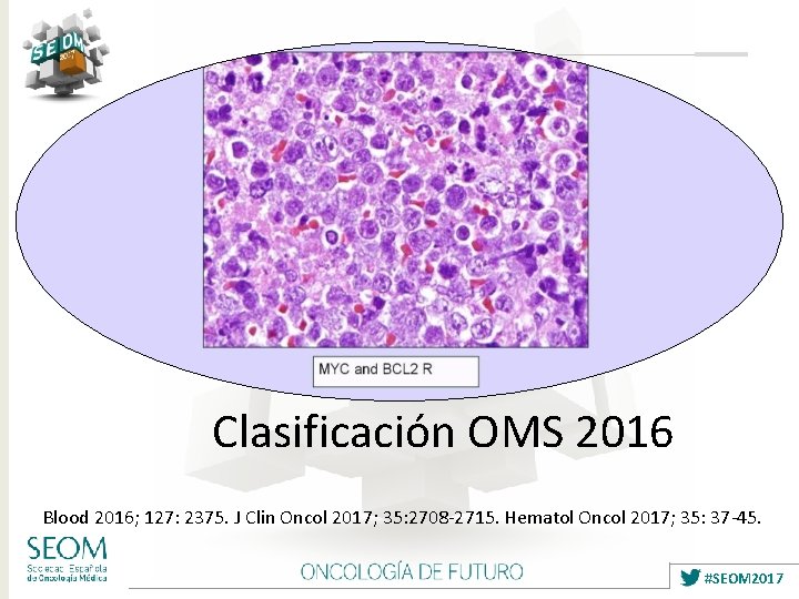 Clasificación OMS 2016 Blood 2016; 127: 2375. J Clin Oncol 2017; 35: 2708 -2715.