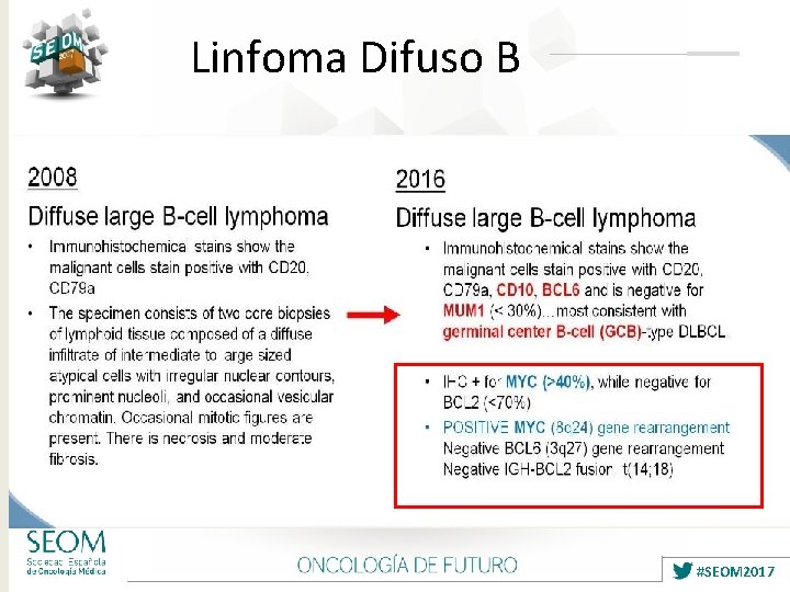 Linfoma Difuso B #SEOM 2017 