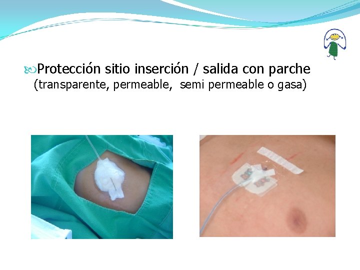  Protección sitio inserción / salida con parche (transparente, permeable, semi permeable o gasa)