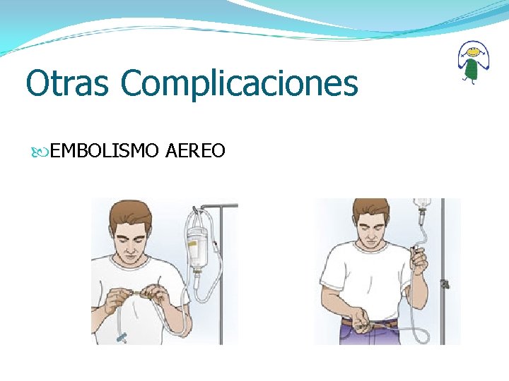 Otras Complicaciones EMBOLISMO AEREO 