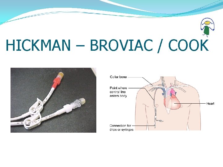 HICKMAN – BROVIAC / COOK 