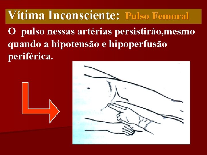Vítima Inconsciente: Pulso Femoral O pulso nessas artérias persistirão, mesmo quando a hipotensão e