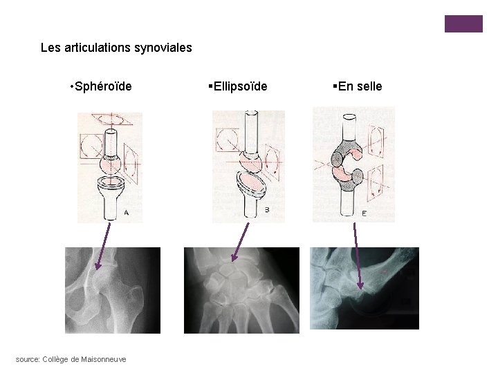 Les articulations synoviales • Sphéroïde source: Collège de Maisonneuve §Ellipsoïde §En selle 