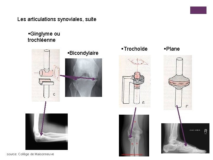 Les articulations synoviales, suite §Ginglyme ou trochléenne §Bicondylaire source: Collège de Maisonneuve §Trochoïde §Plane