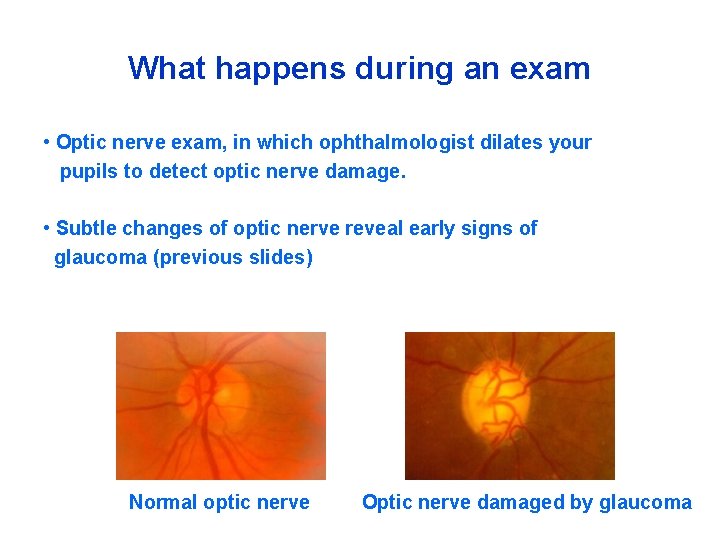 What happens during an exam • Optic nerve exam, in which ophthalmologist dilates your