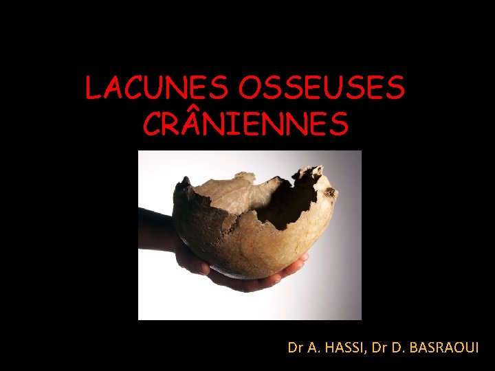 LACUNES OSSEUSES CR NIENNES Dr A. HASSI, Dr D. BASRAOUI 