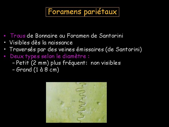 Foramens pariétaux • • Trous de Bonnaire ou Foramen de Santorini Visibles dès la