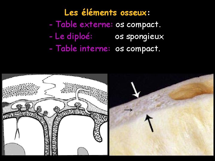 Les éléments osseux: - Table externe: os compact. - Le diploé: os spongieux -