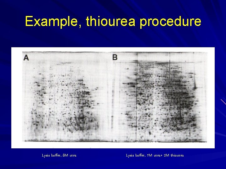 Example, thiourea procedure Lysis buffer, 8 M urea Lysis buffer, 7 M urea+ 2 Example, thiourea procedure Lysis buffer, 8 M urea Lysis buffer, 7 M urea+ 2