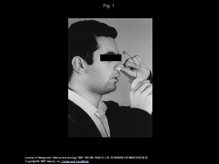 Fig. 1 Journal of Allergy and Clinical Immunology 1997 100158 -164 DOI: (10. 1016/S