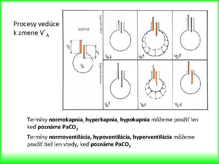 Procesy vedúce k zmene V´A Termíny normokapnia, hyperkapnia, hypokapnia môžeme použiť len keď poznáme