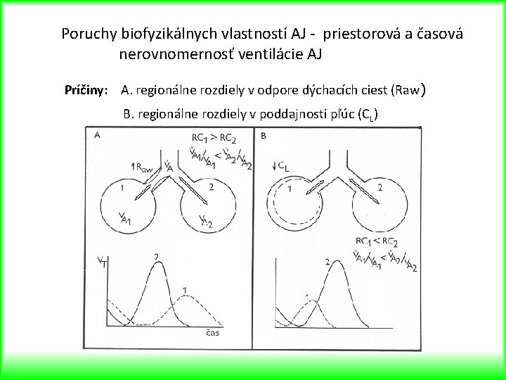Poruchy biofyzikálnych vlastností AJ - priestorová a časová nerovnomernosť ventilácie AJ Príčiny: A. regionálne