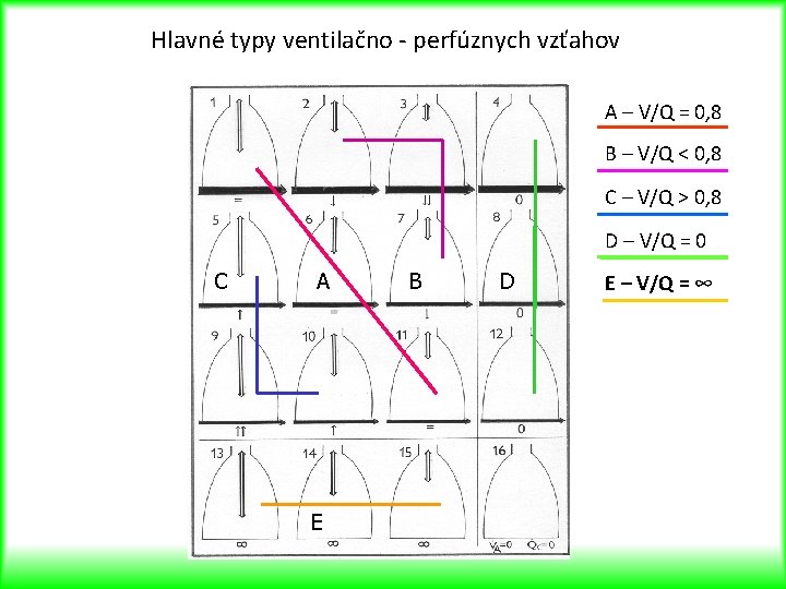 Hlavné typy ventilačno - perfúznych vzťahov A – V/Q = 0, 8 B –