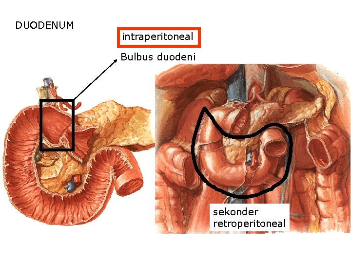 DUODENUM intraperitoneal Bulbus duodeni sekonder retroperitoneal 