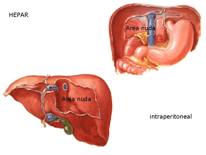 HEPAR Area nuda intraperitoneal 