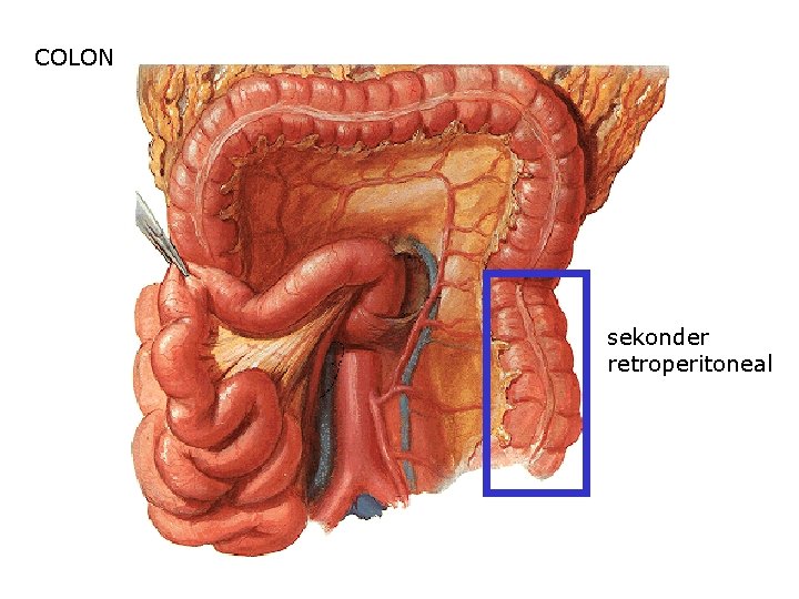 COLON sekonder retroperitoneal 