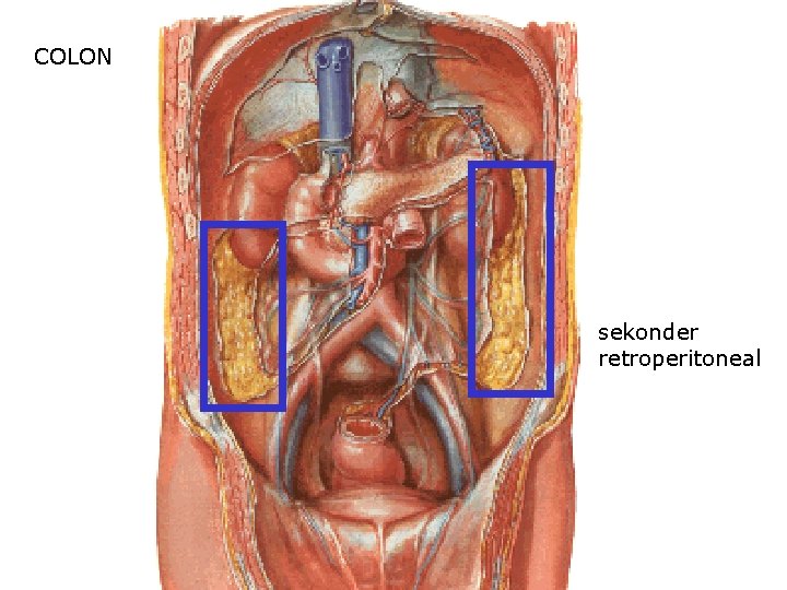 COLON sekonder retroperitoneal COLON sekonder retroperitoneal