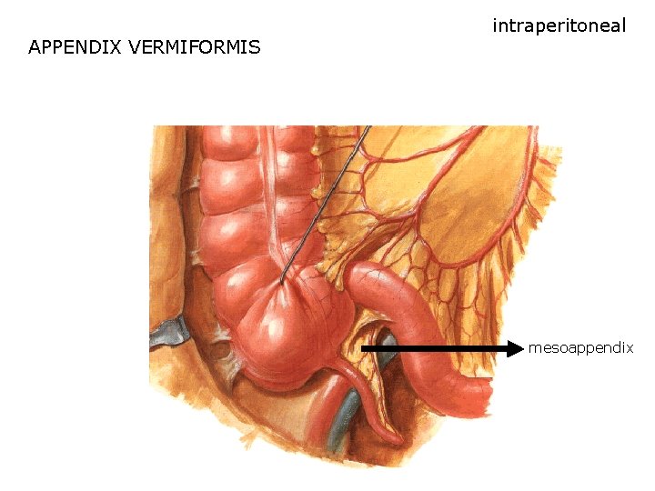 APPENDIX VERMIFORMIS intraperitoneal mesoappendix APPENDIX VERMIFORMIS intraperitoneal mesoappendix