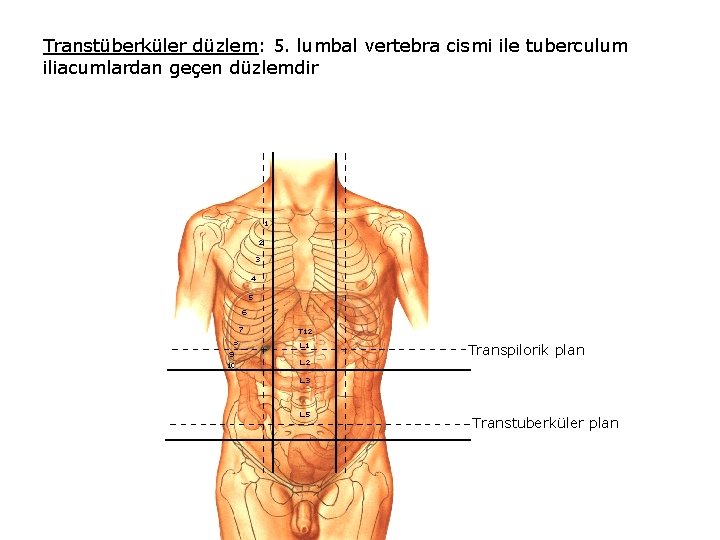 Transtüberküler düzlem: 5. lumbal vertebra cismi ile tuberculum iliacumlardan geçen düzlemdir Transpilorik plan Transtuberküler