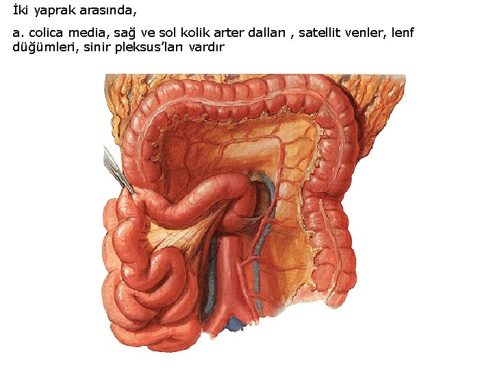 İki yaprak arasında, a. colica media, sağ ve sol kolik arter dalları , satellit İki yaprak arasında, a. colica media, sağ ve sol kolik arter dalları , satellit