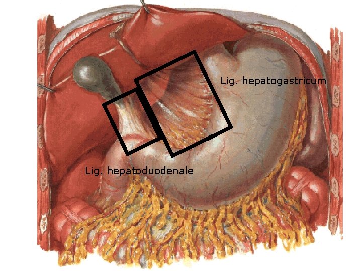 Lig. hepatogastricum Lig. hepatoduodenale 