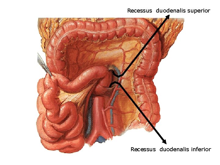 Recessus duodenalis superior Recessus duodenalis inferior 