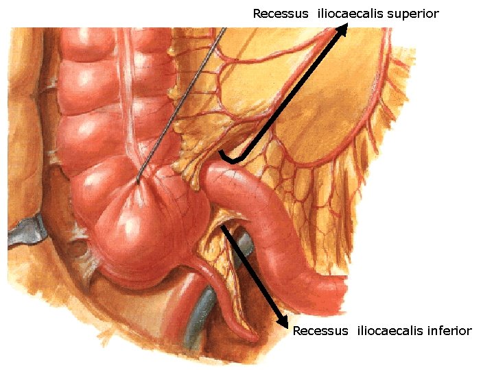 Recessus iliocaecalis superior Recessus iliocaecalis inferior 