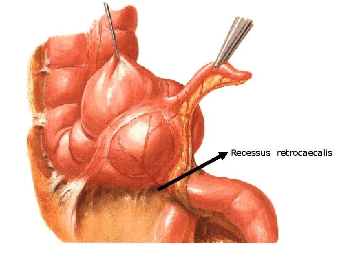 Recessus retrocaecalis 