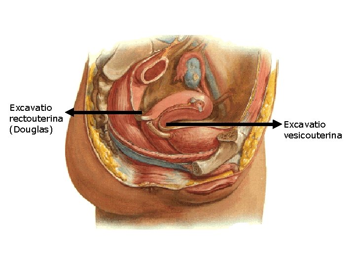 Excavatio rectouterina (Douglas) Excavatio vesicouterina 