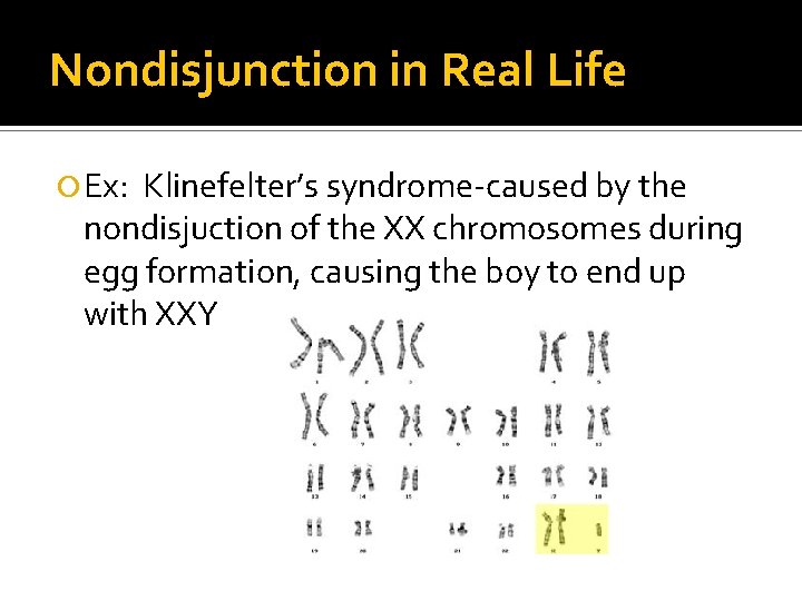 Nondisjunction in Real Life Ex: Klinefelter’s syndrome-caused by the nondisjuction of the XX chromosomes