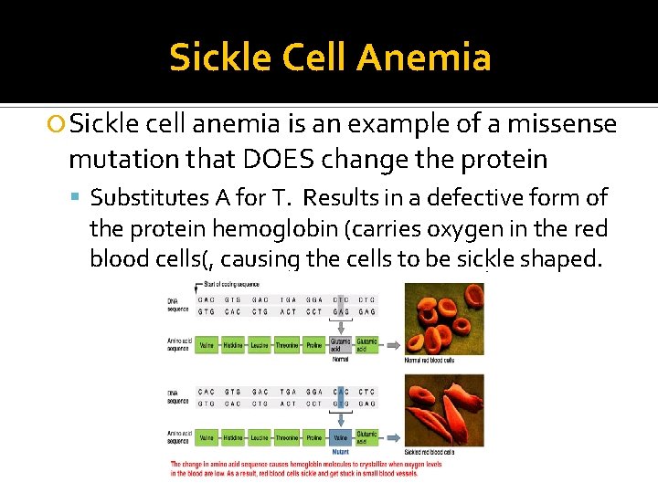 Sickle Cell Anemia Sickle cell anemia is an example of a missense mutation that