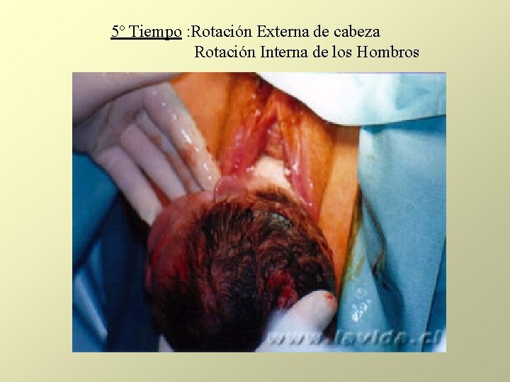 5º Tiempo : Rotación Externa de cabeza Rotación Interna de los Hombros 5º Tiempo : Rotación Externa de cabeza Rotación Interna de los Hombros