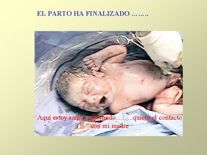 EL PARTO HA FINALIZADO ……. . Aquí estoy sanito y llorando……. . quiero el EL PARTO HA FINALIZADO ……. . Aquí estoy sanito y llorando……. . quiero el