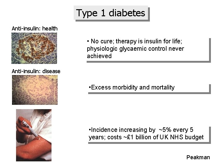 Type 1 diabetes Anti-insulin: health • No cure; therapy is insulin for life; physiologic