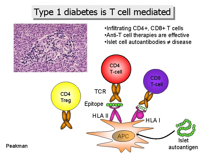 Type 1 diabetes is T cell mediated • Infiltrating CD 4+, CD 8+ T