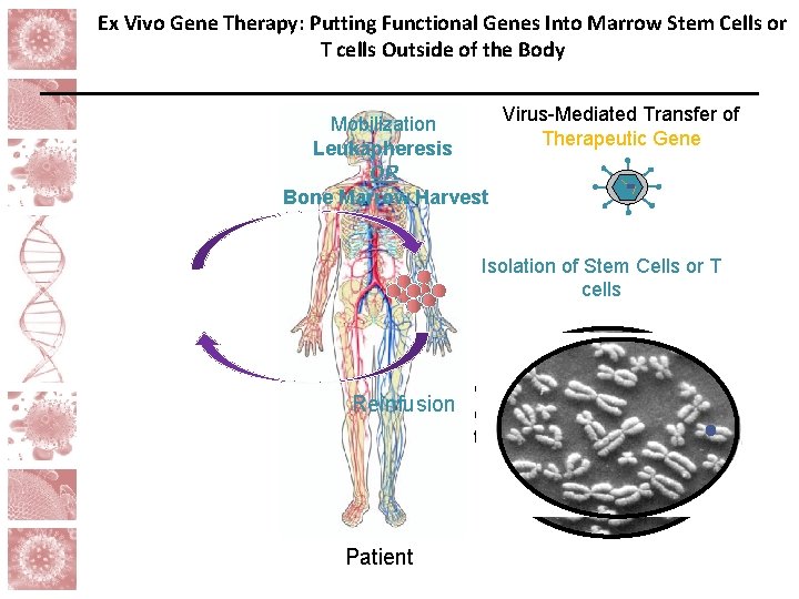 Ex Vivo Gene Therapy: Putting Functional Genes Into Marrow Stem Cells or T cells